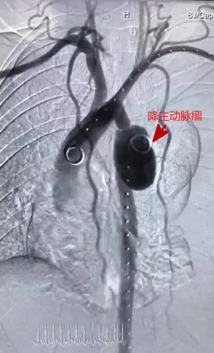 (高处坠落解释)不幸累倒的侠客！高处坠落险象环生，命悬一线