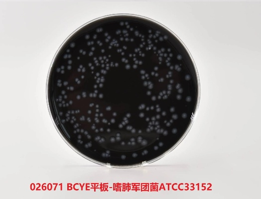 (军团菌培养常用培养基)探索军团菌培养基的制备、应用及在疾病研究中的潜力